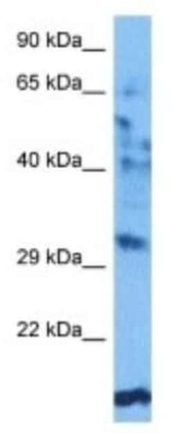 OR52A1 Rabbit anti-Human, Polyclonal, Novus Biologicals:Antibodies:Primary
